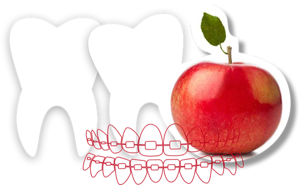 Illustration von Zähnen, einer Zahnspange und ein Foto von einem Apfel